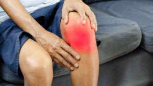 cxarticular2